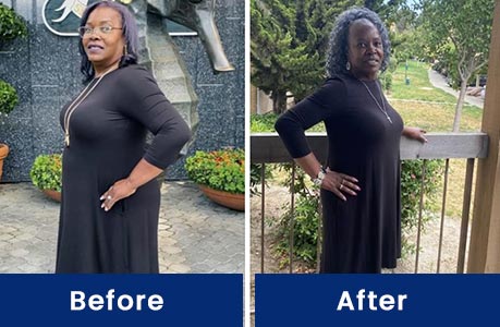Body Contouring