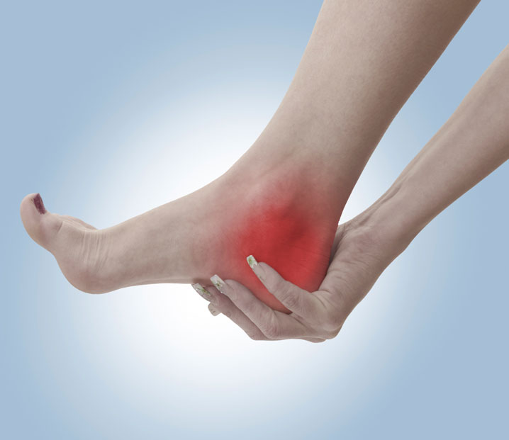 Marin Plantar Fasciitis Chiropractors