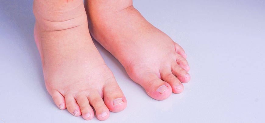 patient needing diabetic neuropathy treatment in Novato