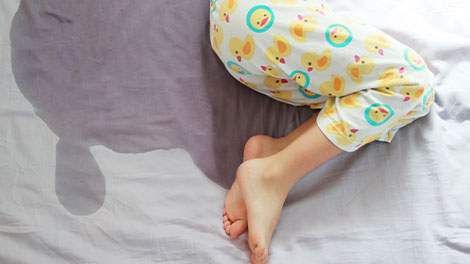patient requiring enuresis treatment in Novato