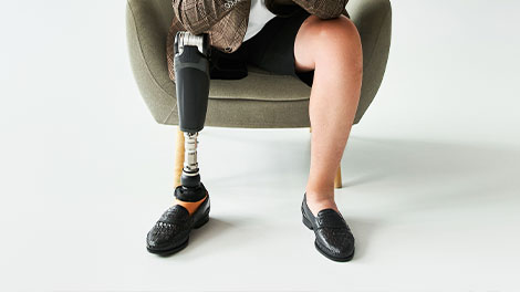 patient requiring phantom limb syndrome treatment in Novato