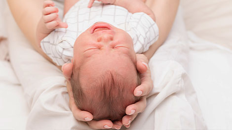 patient requiring plagiocephaly treatment in Novato