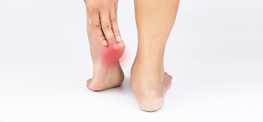 patient needing plantar fasciitis treatment in Novato