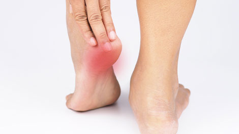 patient requiring plantar fasciitis treatment in Novato