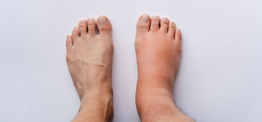 patient needing reflex sympathetic dystrophy treatment in Novato
