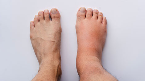 patient requiring reflex sympathetic dystrophy treatment in Novato