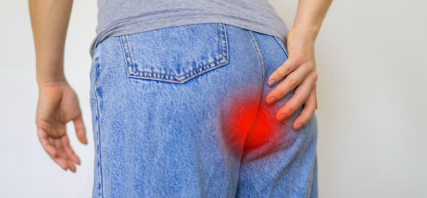 patient needing tailbone pain treatment in Novato