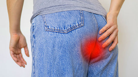 patient requiring tailbone pain treatment in Novato