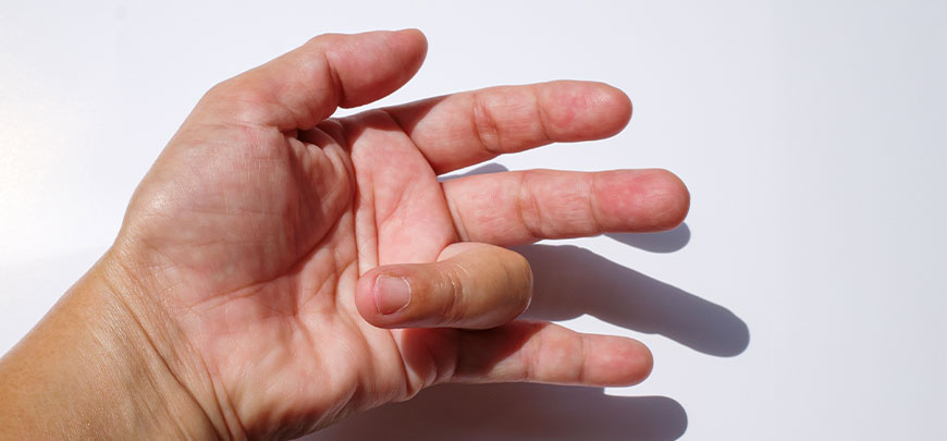 patient needing trigger finger treatment in Novato